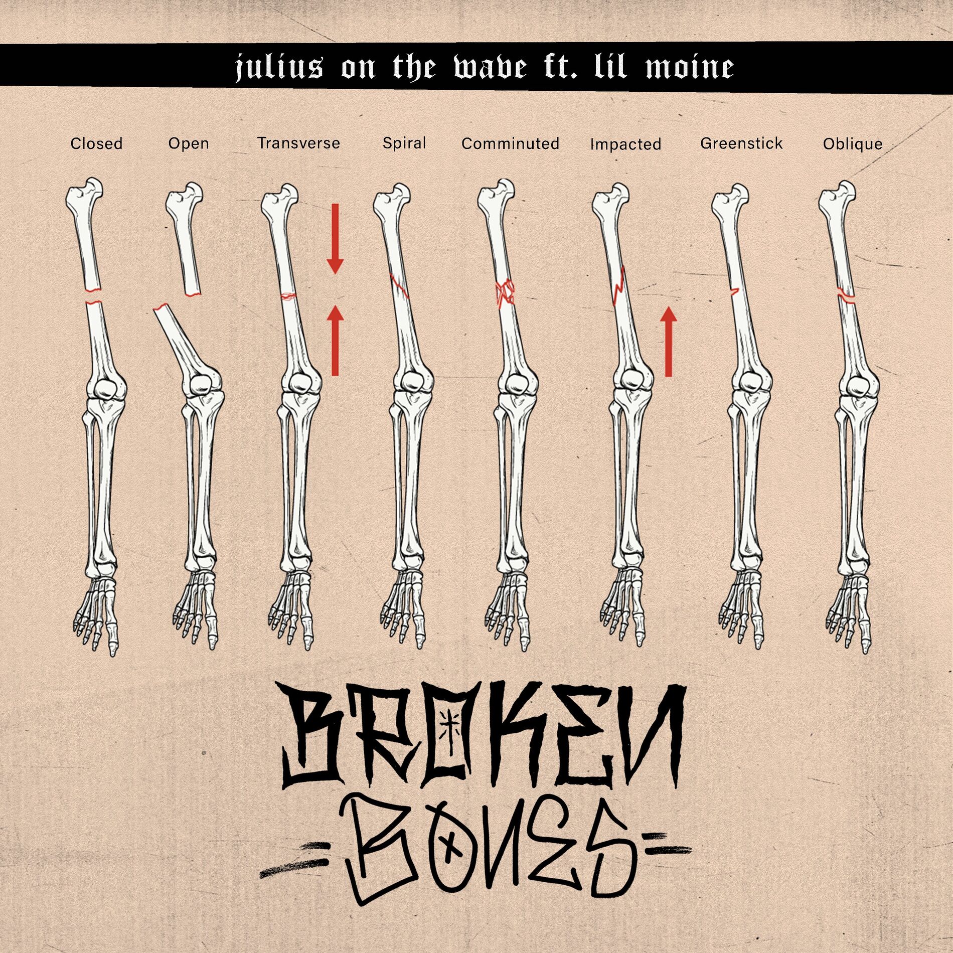Album cover of BROKEN BONES