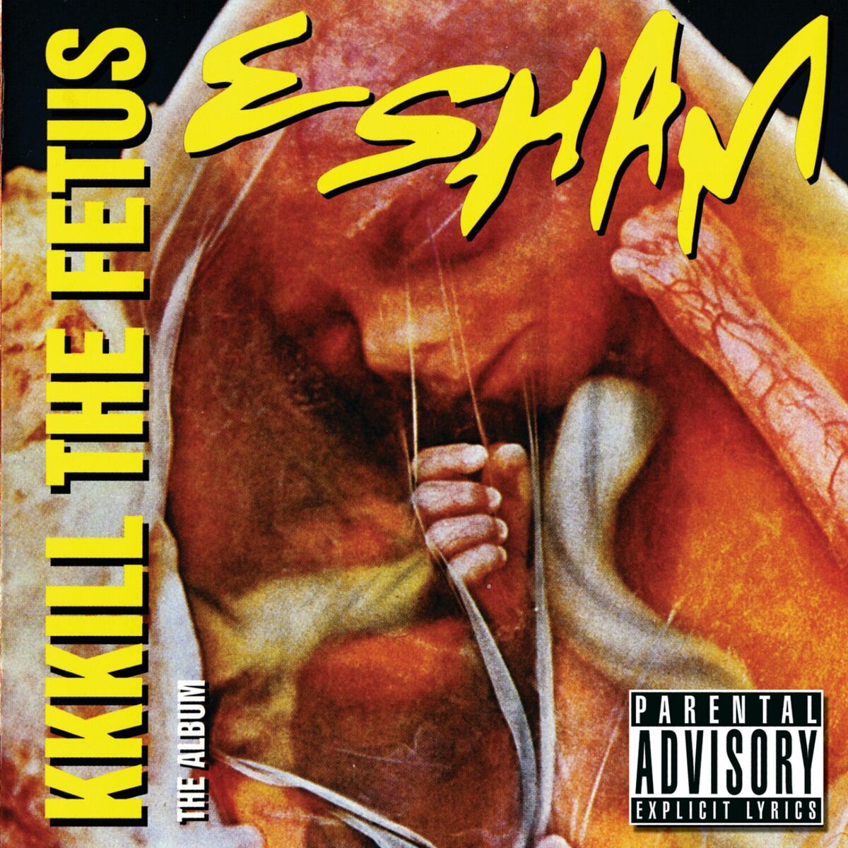 Album cover of KKKill The Fetus