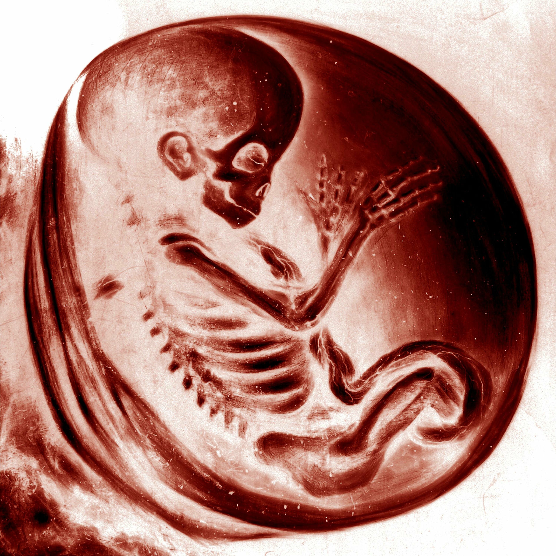 Album cover of Embryodead