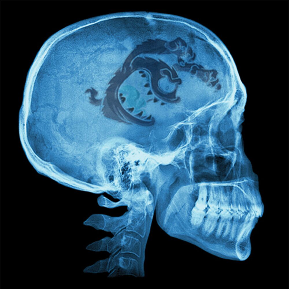 Picture of Dentro de Mi Cabeza