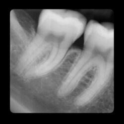 Cover of Teeth