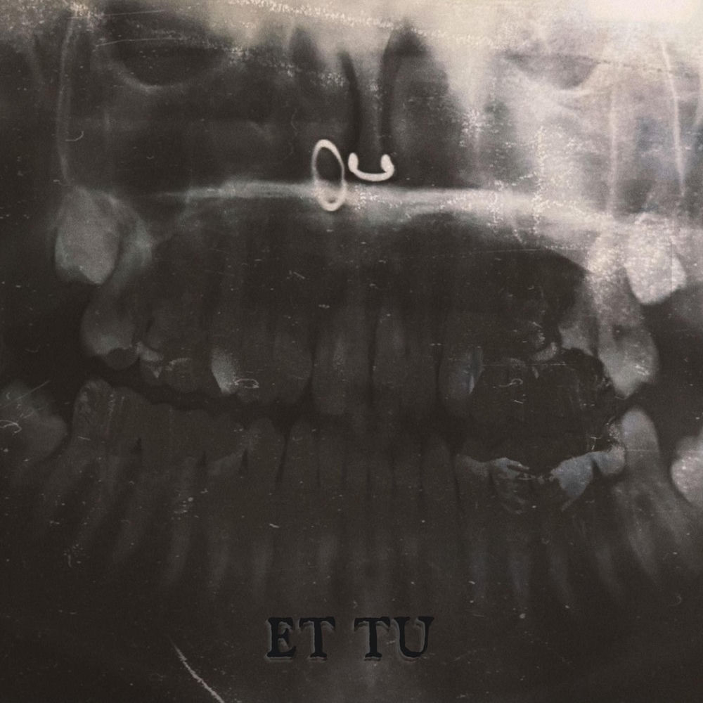 gut me by chestr
