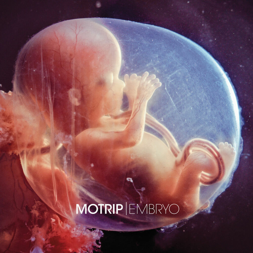 Picture of Embryo