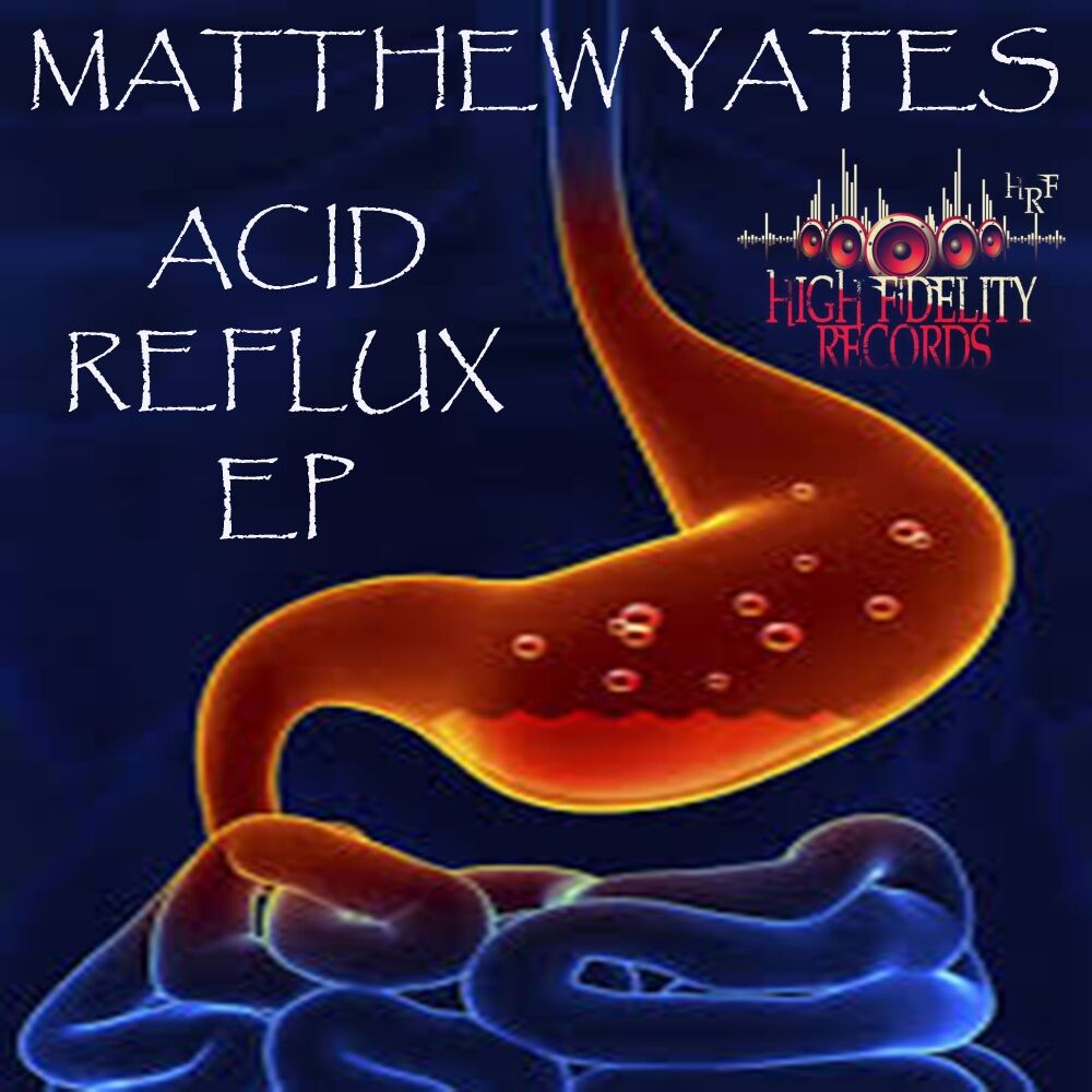 Picture of Acid Reflux EP