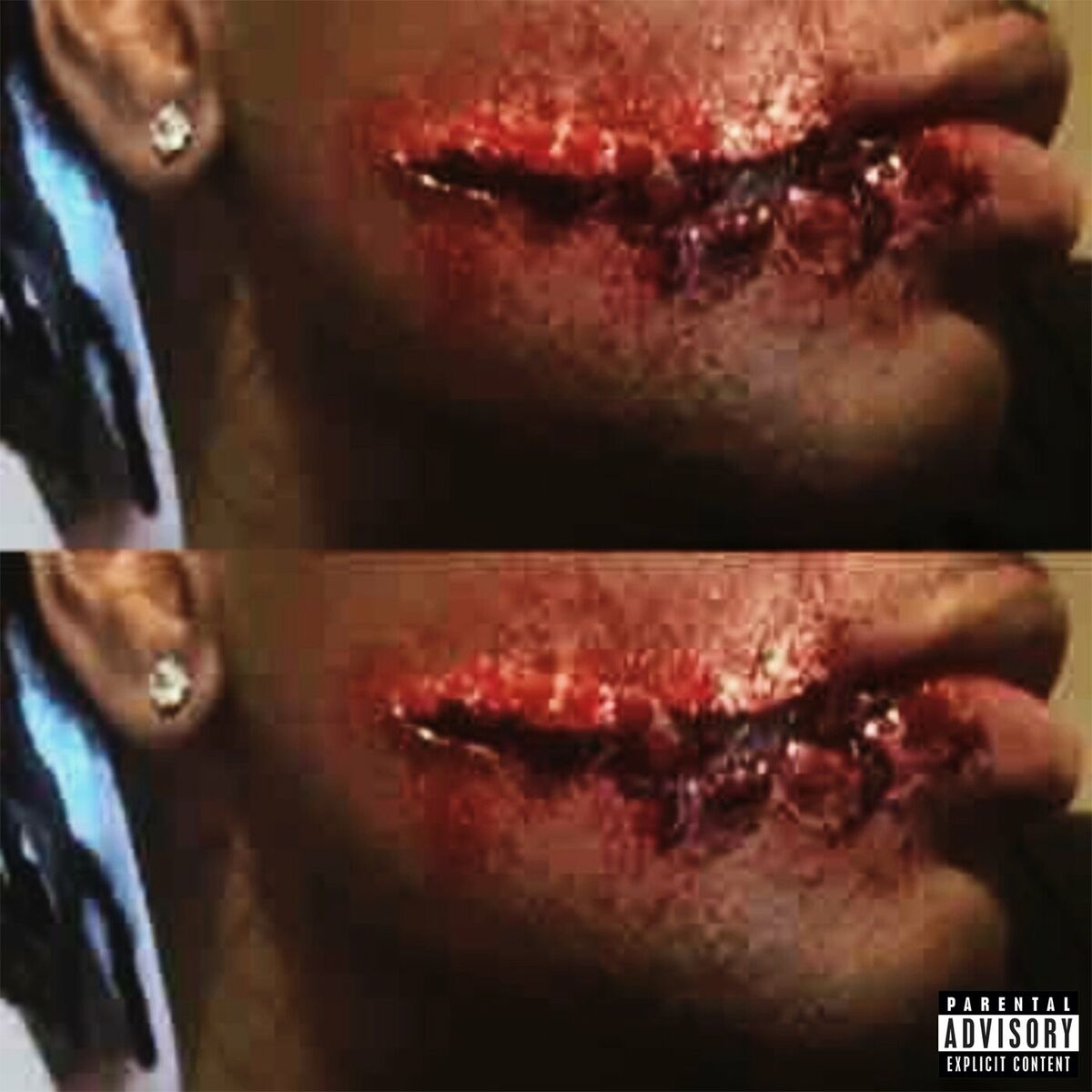 Album cover of overseas