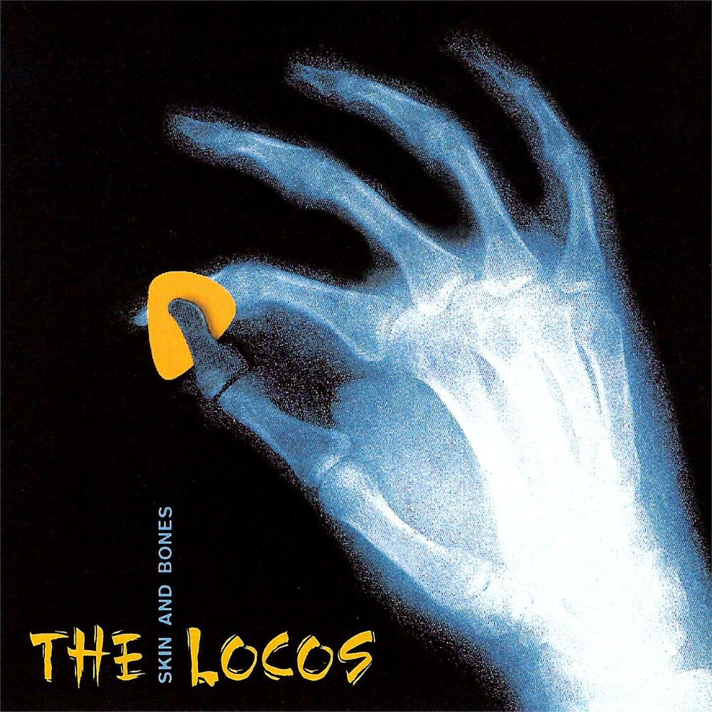 Picture of Skin and bones