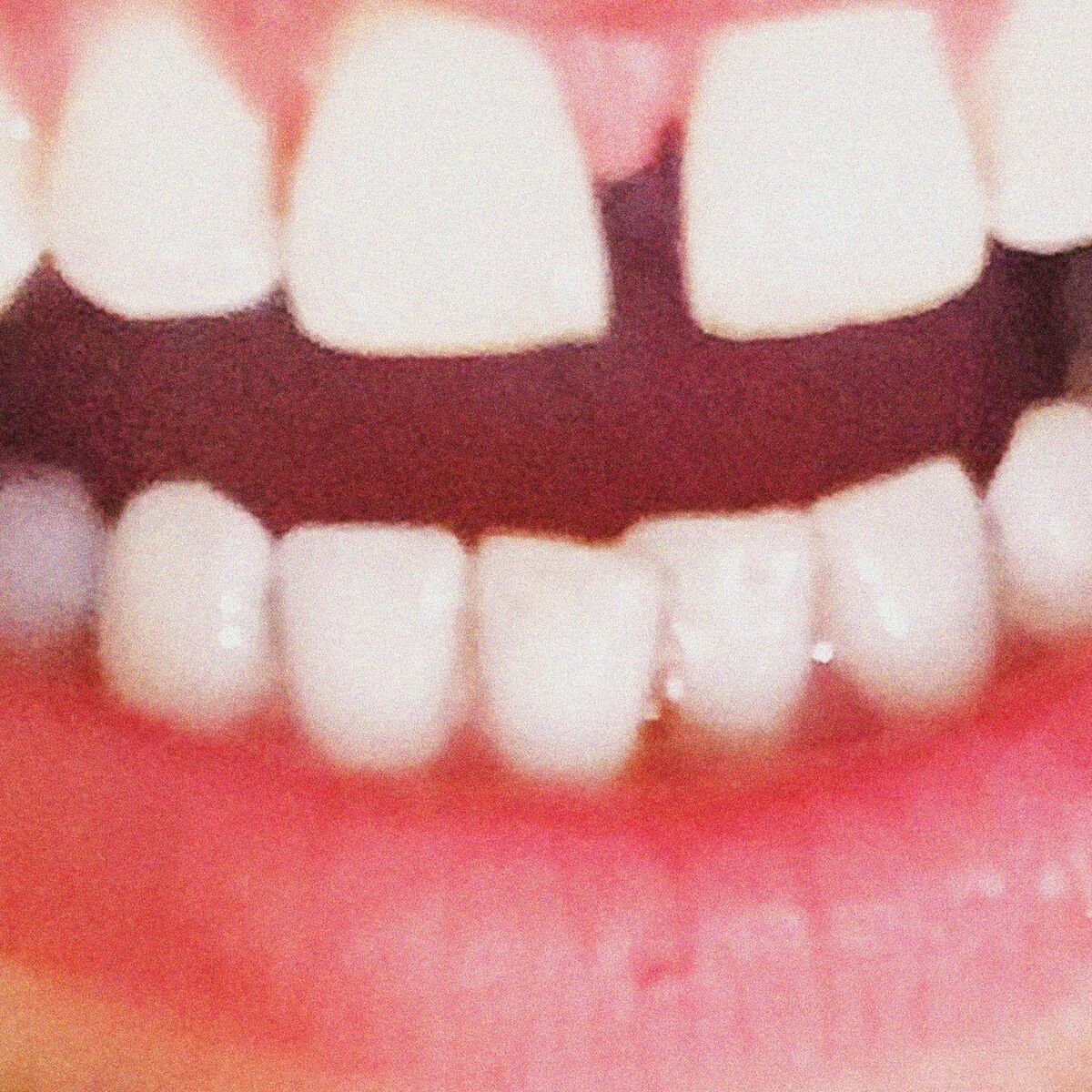 Album cover of Oaoa