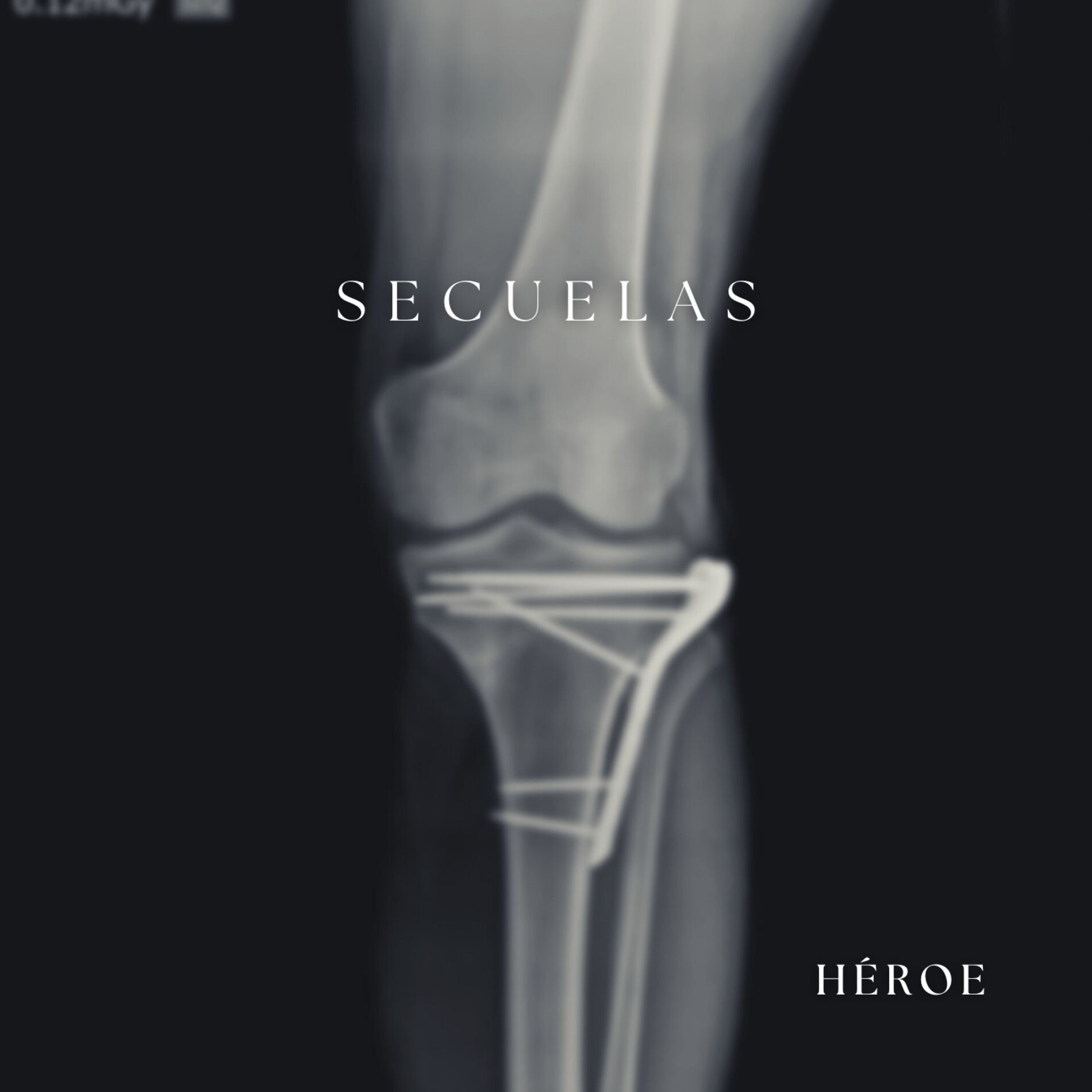 Album cover of Secuelas