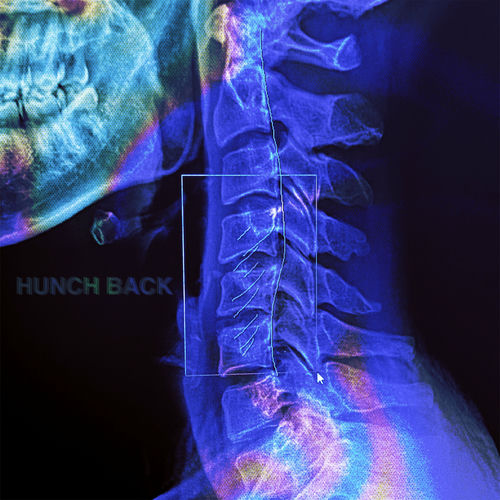 Reddy – HUNCHBACK – Single