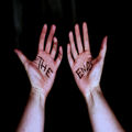 Scars