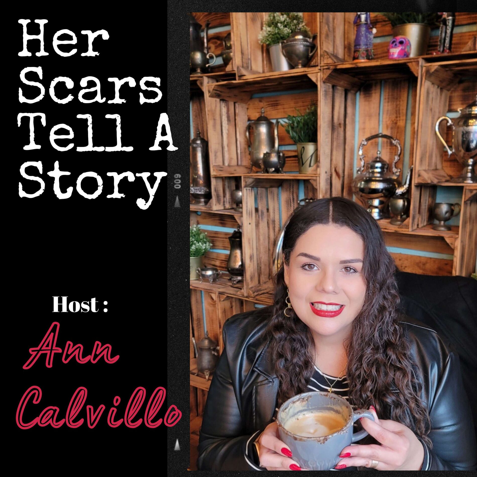 Show cover of Her Scars Tell A Story