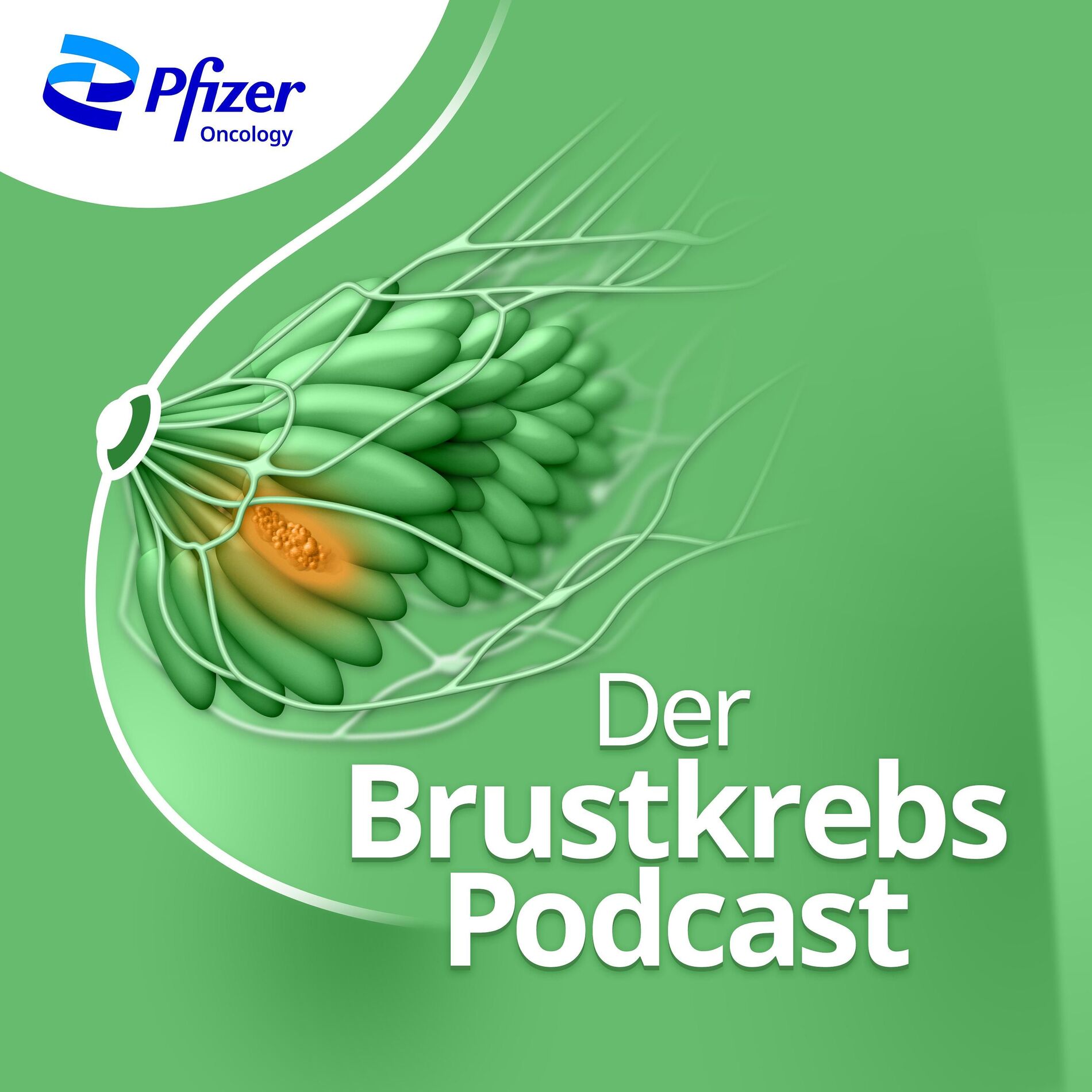 Show cover of Der Brustkrebs Podcast