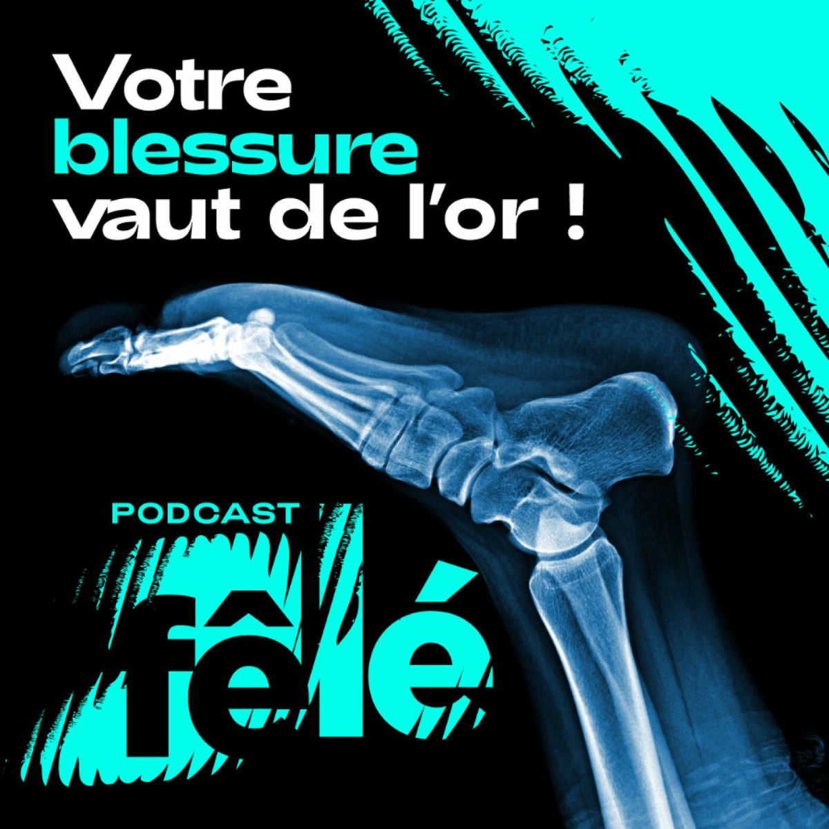 Show cover of Fêlé, votre blessure vaut de l'or