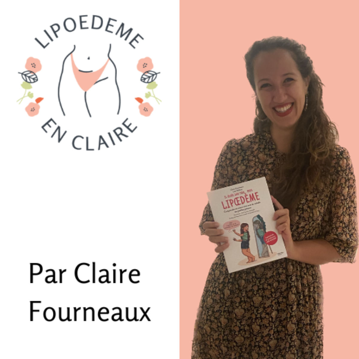 Show cover of Lipoedeme en Claire